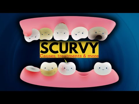 8 Signs You May be Vitamin B12 Deficient