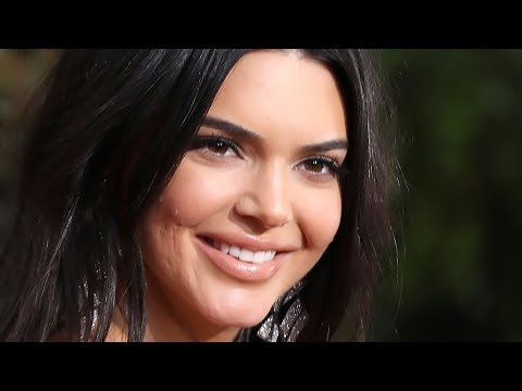 Watch lagu Images Videos Celebrity Acne 2018, Watch Images Celebrity Acne 2018 free Watch, Watch Images Celebrity Acne 2018