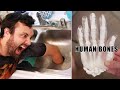 What Happens if You Put Your Hand in a Garbage Disposal?