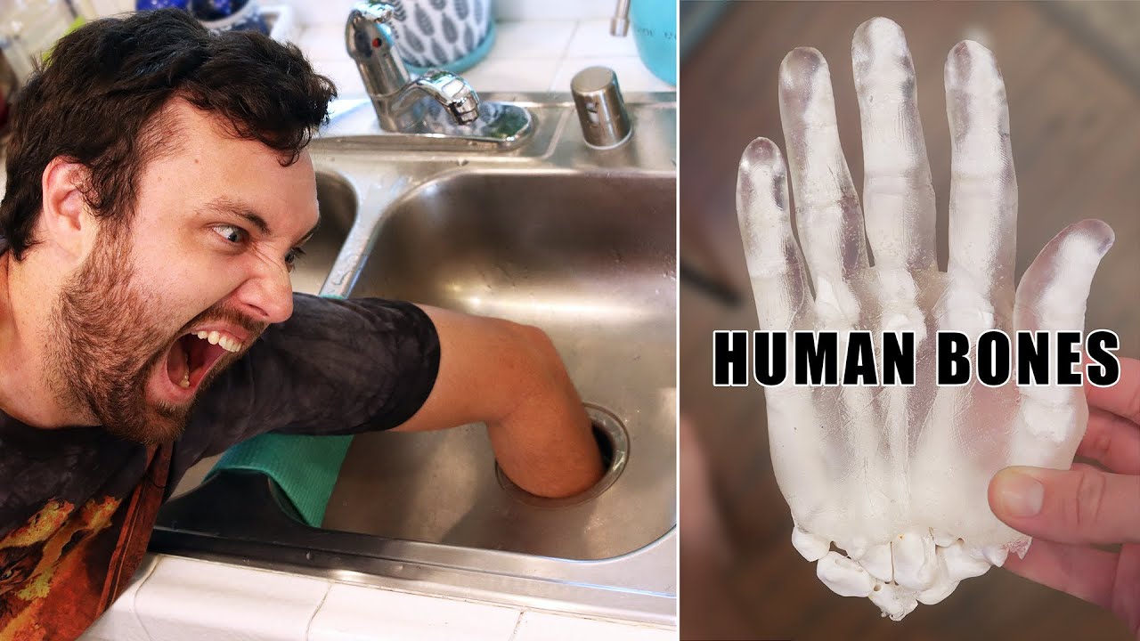 What Happens if You Put Your Hand in a Garbage Disposal