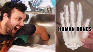 What Happens if You Put Your Hand in a Garbage Disposal?