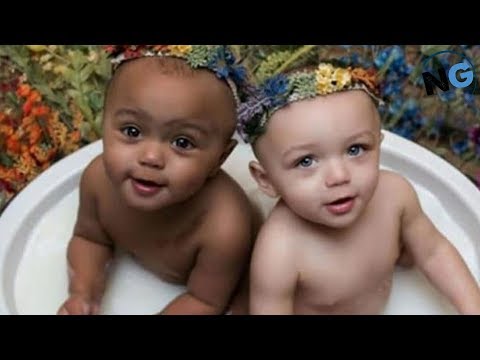 These Twins With Different Skin Colors Are ‘1 In A Million’ – Here They Are All Grown Up