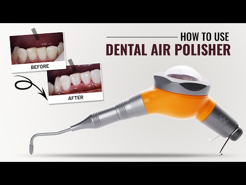 How to use Dental Air Polisher | Waldent Premium Air Polisher