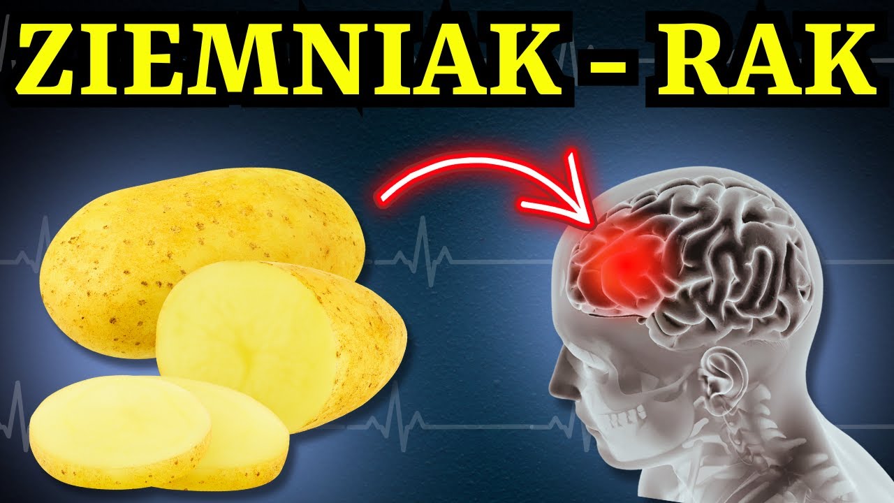 NIGDY nie jedz ZIEMNIAKÓW z TYMI produktami… Ryzyko RAKA i DEMENCJI. 3 NAJGORSZE połączenia. Część 2