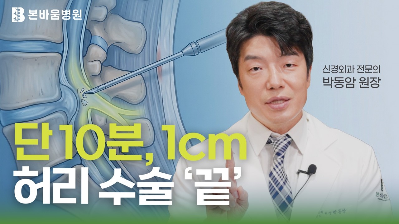 오전에 수술하고 오후에 걷는다? 1cm 척추 내시경이 만든 일상의 기적