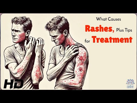 Rashes 101: Causes, Symptoms, and Quick Relief Tips