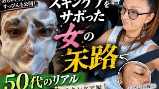 50代シミだらけの肌さらけ出します　スキンケア編　誰か助けて