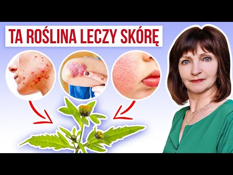 1 zioło na 8 sposobów – Leczy ŁUSZCZYCĘ, EGZEMĘ, RZS i REFLUKS. Uczep trójlistkowy