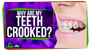 Why Do We Have Such Crooked Teeth?