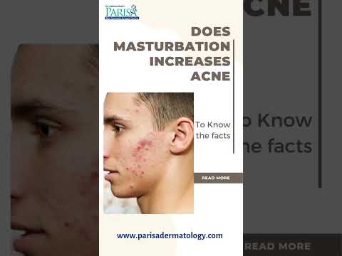 Facts : You should know about Masturbation and Acne #drashimagoel #parisaskinclinic #youtubeshorts