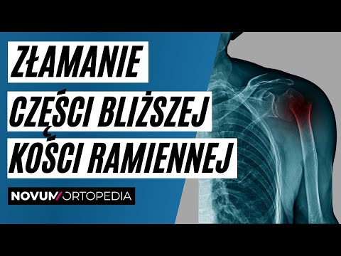 Złamania części bliższej kości ramiennej | Novum Ortopedia