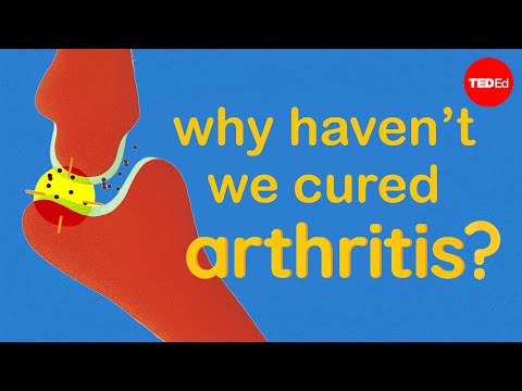 The Science of Arthritis and Why We Still Have No Cure