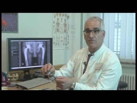 Hip Replacement in Kursk, wo tun Behandlung von Hüft-Medikamente
