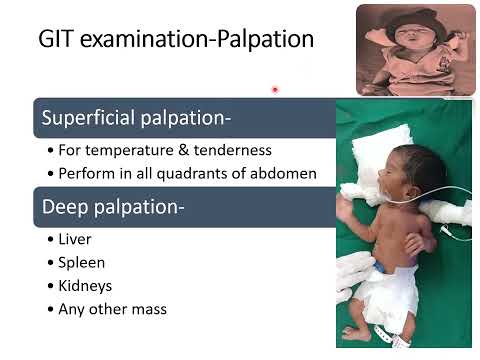 Abdominal Examination in Newborn | Newborn Examination (Part-5) | Pediatrics
