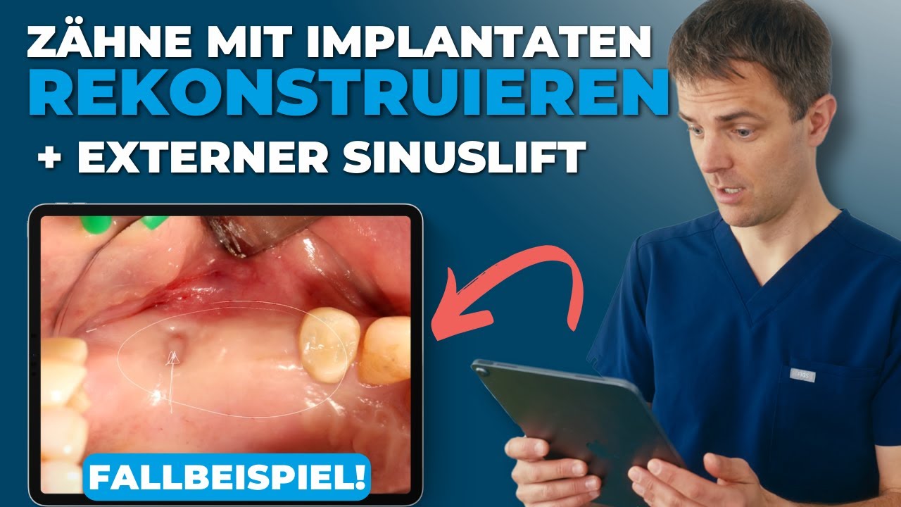 Video-Vorschaubild