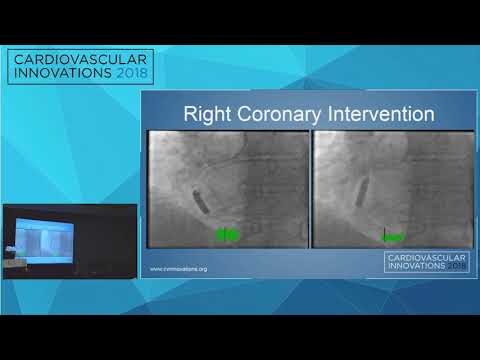 CVI2018 Session: Outpatient Cath Surprise - Rahul Sharma, MD