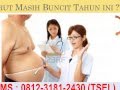 Fiforlif Amankah ? Atau Ada Efek Sampingnya? Fiforlif Amankah ? Atau Ada Efek Sampingnya?
