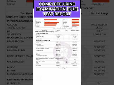 COMPLETE URINE EXAMINATION (CUE) TEST REPORT #shorts #viral #urine