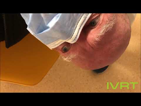 Positiver Dix-Hallpike Test - Lagerungsschwindel im linken, hinteren Bogengang