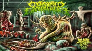 Cerebral Engorgement - Gastrointestinal Bleeding (2013) {Full-Album}
