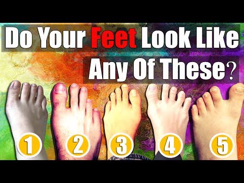 download lagu mp3 mp4 Different Feet Shapes, download lagu Different Feet Shapes gratis, unduh video klip Different Feet Shapes