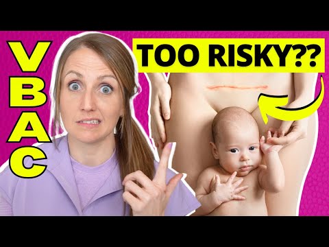 VBAC or Elective C-Section: Doctor Explains The Risks