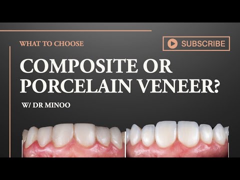 Which is better? Porcelain or Composite veneers?