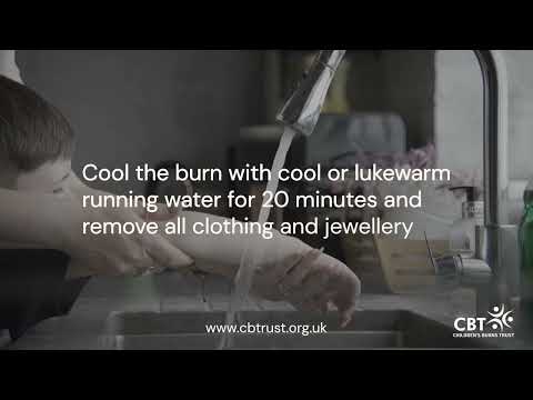 First Aid for Burns and Scalds