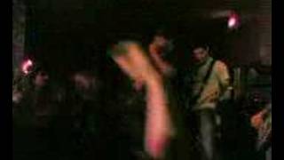 Remembering Never Incisions