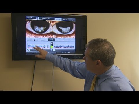 Breakthrough in treatment of Dry Eye Syndrome