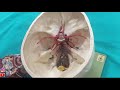 Merkezi Sinir Sistemi MSS Arterleri