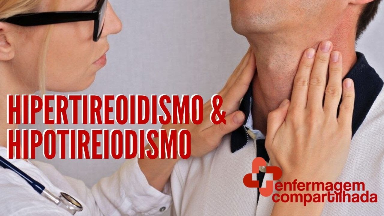 HIPERTIREODISMO e HIPOTIREOIDISMO: Fisiopatologia e condutas de Enfermagem