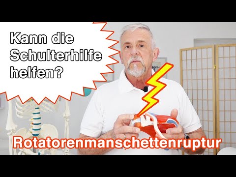 Rotatorenmanschettenruptur ⚡ Was ist das? | Kann die Schulterhilfe helfen?