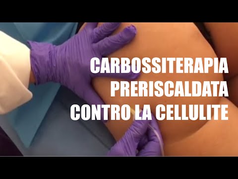 Slogate foto caviglia sintomi Dolore persistente nelle cause testa e del collo