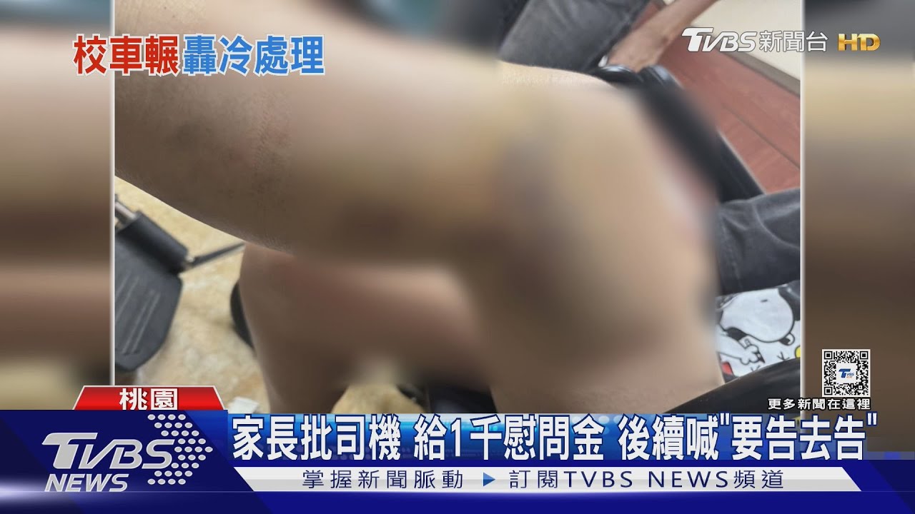 「這輩子沒這麼痛過」　高一女搭校車腿遭輾