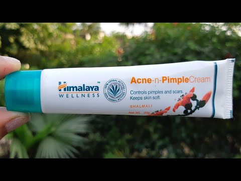 Himalaya herbals acne & pimple cream review, anti acne cream...