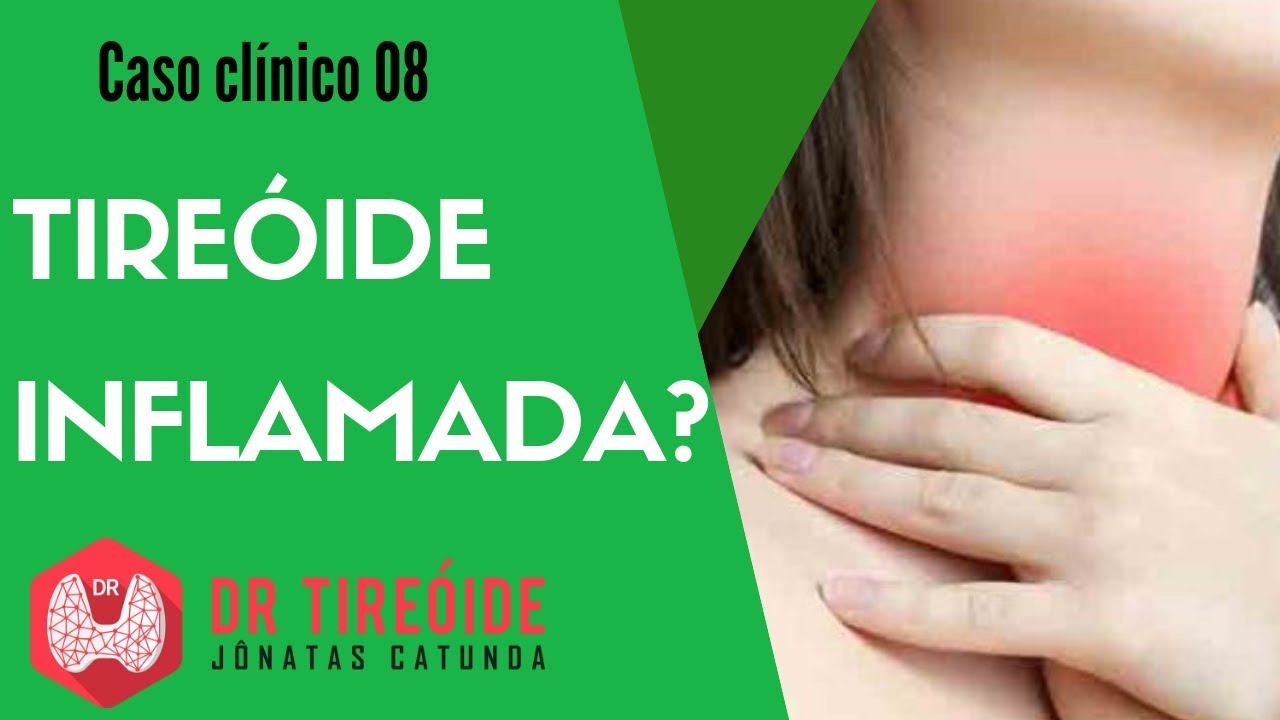 Tireóide inflamada?  - Caso clínico #08# | Dr Jônatas Catunda