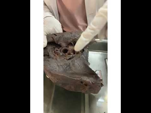 demonstration of lung  part 1 borders, surfaces lobes and side determination