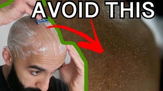 HEAD SHAVING FOR SENSITIVE SKIN - How Would Your Skin React To Razor Shaving EVERY DAY? A Experiment