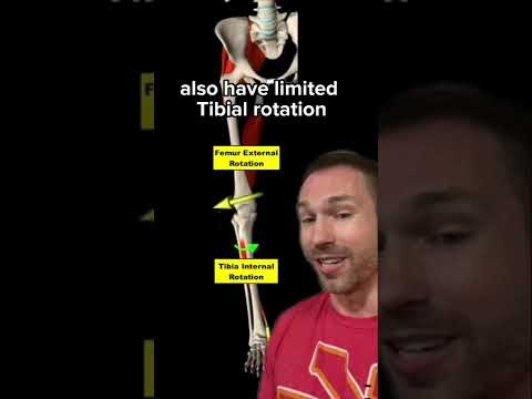 Have REALLY BAD Ankle Mobility? (TRY THIS)