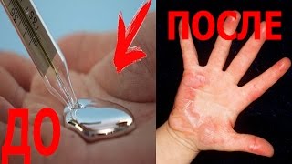 ЧТО БУДЕТ, ЕСЛИ РАЗБИТЬ РТУТНЫЙ ГРАДУСНИК ?