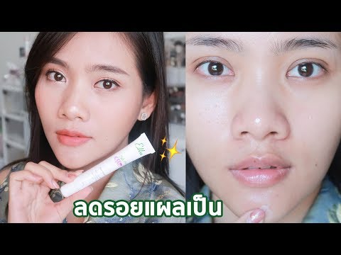 ครีมลดรอยแผลเป็น ที่ขายดีที่สุด 5 ปี ซ้อน !!!!