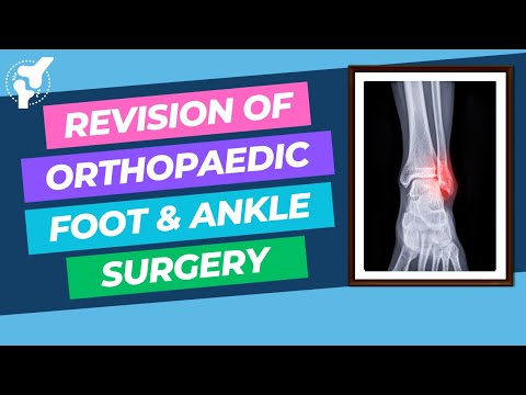 OrthoReview - chirurgia stopy i stawu skokowego – przygotowanie do egzaminów ortopedycznych