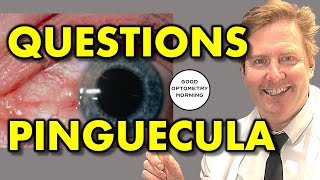 PINGUECULA QUESTIONS ANSWERED by YouTube Eye Doctor & Optometrist; yellow spot on eye explained