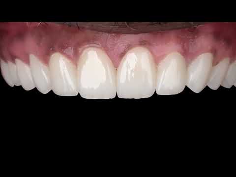 تجميل اسنان في عيادة دكتورة ايمان طنطاوي بمصر