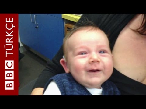 İşitme engelli bir bebeğin anne babasını duyduğu ilk an - BBC TÜRKÇE