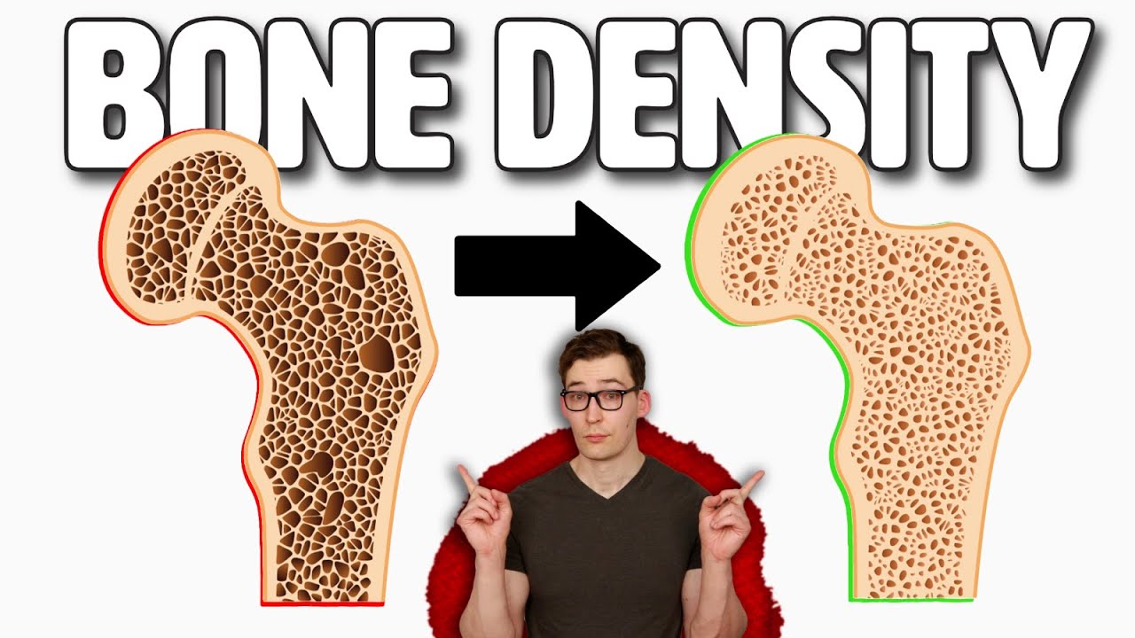 Boost your Bone Density with these 3 Tips!