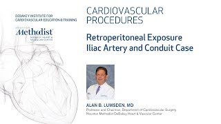 Download Lagu Retroperitoneal Exposure: Iliac Artery and Conduit Case (Alan B. Lumsden, MD) Thumbnail