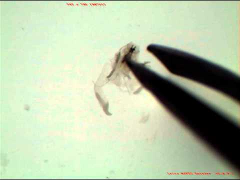 Drosophila Salivary Gland Dissection