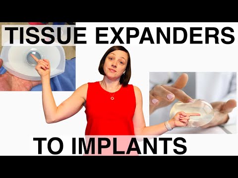 Breast Reconstruction Exchange Surgery - What to Expect